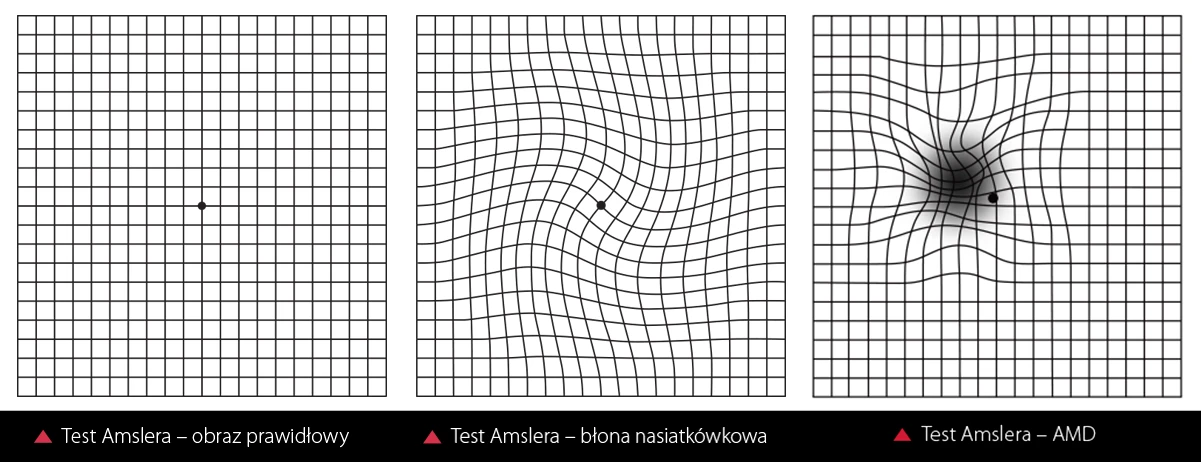 test Amslera AMD